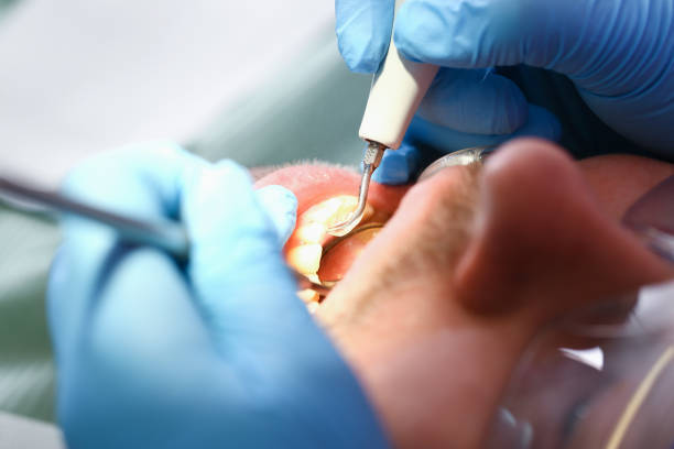 Best Emergency Treatment for Dental Infections or Abscesses in Holiday Island, AR
