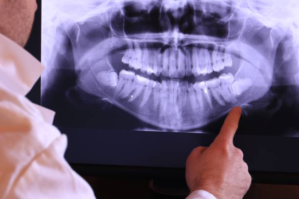 Best Emergency Dental Care for Broken or Chipped Teeth in Holiday Island, AR