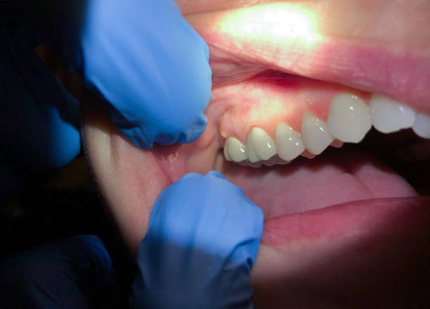 Best Emergency Denture Repair in Holiday Island, AR