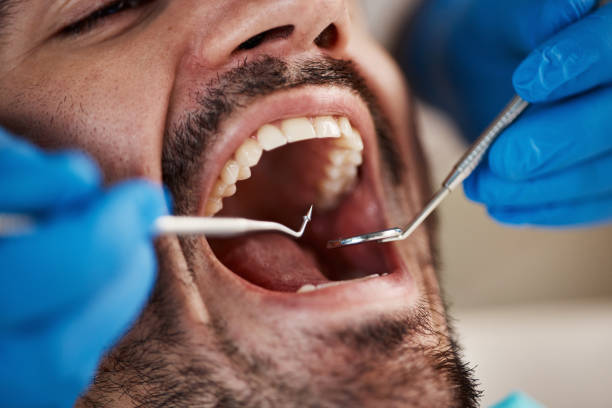 Best After-Hours Dental Trauma Care in Holiday Island, AR