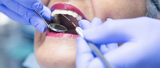 Best Emergency Dental Care for Broken or Chipped Teeth in Holiday Island, AR