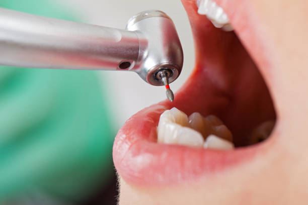 Best Emergency Treatment for Dental Infections or Abscesses in Holiday Island, AR